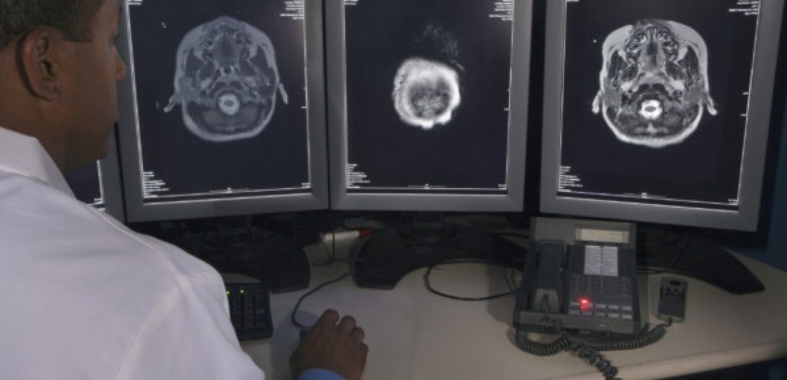 Rear view of African male doctor reviewing at brain scans Final reads for radiology